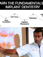 leran the fundamentals of implant dentisy
