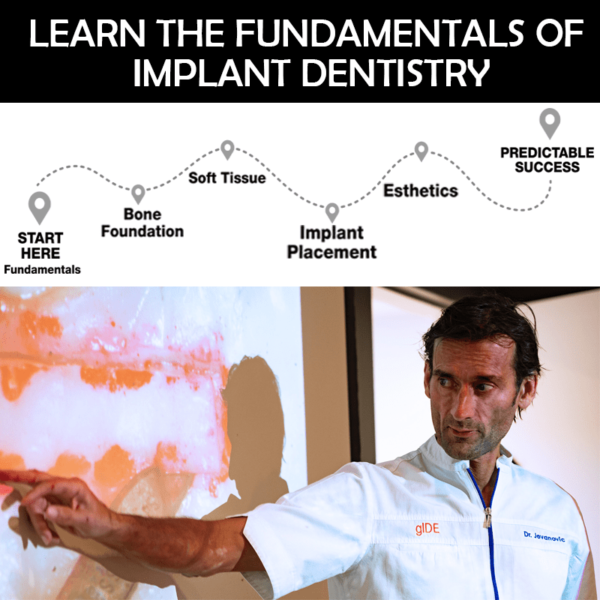 leran the fundamentals of implant dentisy