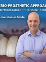 perio-prosthetic approach for fp1 rehabilitations