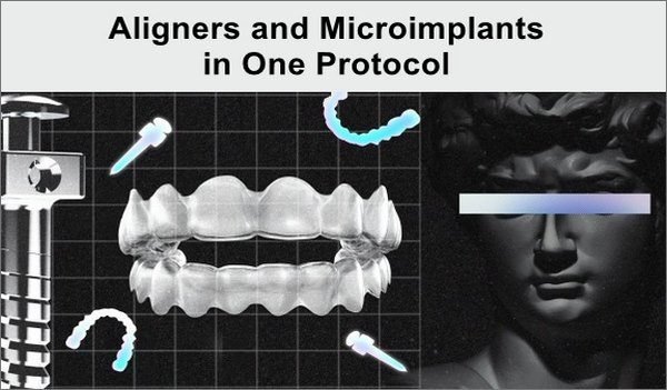 Aligners-and-Microimplants-in-One-Protocol