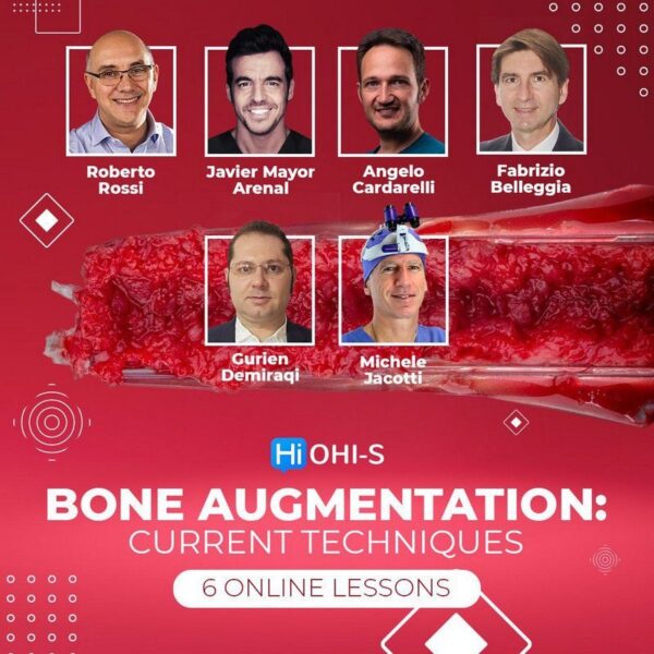 Bone-Augmentation-Current-Techniques