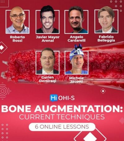 Bone-Augmentation-Current-Techniques