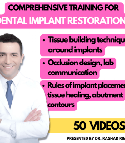 Comprehensive-training-for-dental-implant-restorations