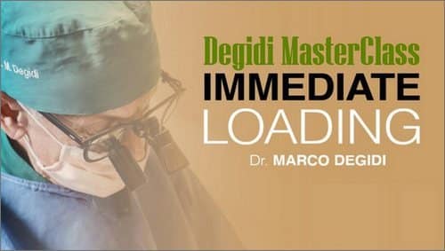 Degidi-MasterClass-Immediate-Loading