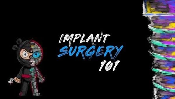 Implant-Ninja-Implant-Surgery