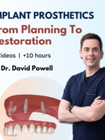 Implant-Prosthetics-from-Planning-to-Restoration
