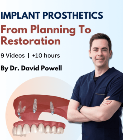 Implant-Prosthetics-from-Planning-to-Restoration