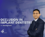 Occlusion-in-Implant-Dentistry