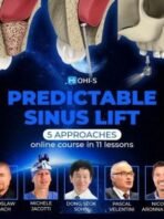 Predictable-sinus-lif