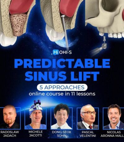 Predictable-sinus-lif