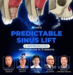 Predictable-sinus-lif