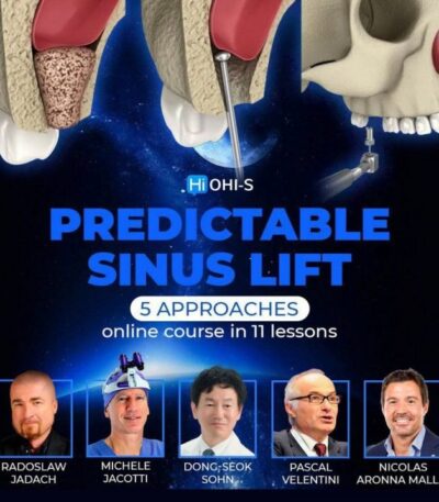 Predictable-sinus-lif