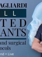 enrico agliardi full tilted implants