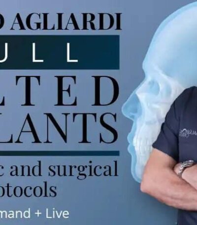 enrico agliardi full tilted implants