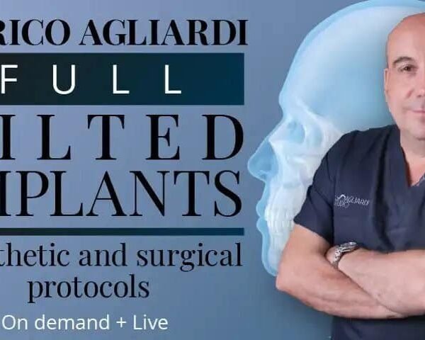 enrico agliardi full tilted implants