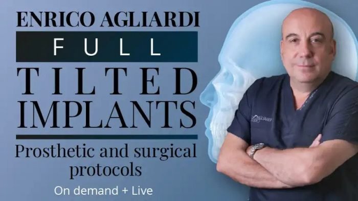 enrico agliardi full tilted implants