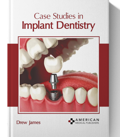 case studies in implant dentistry