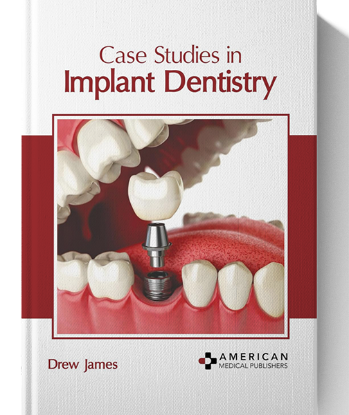 case studies in implant dentistry