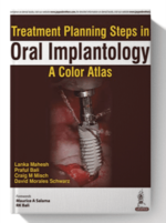 treatment planning steps in oral implantology