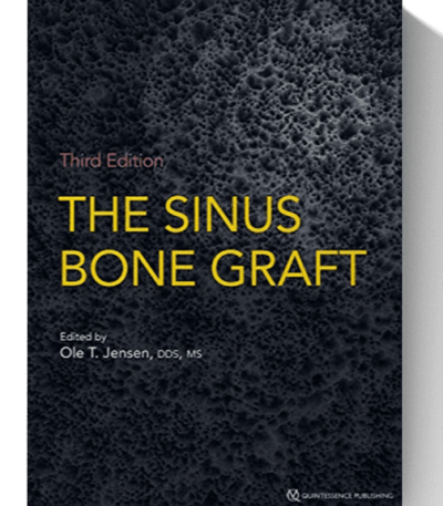 the sinus bone graft