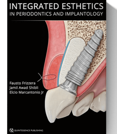 integrated esthetics in periodontics and implantology