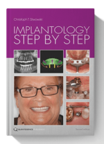 implantology step by step pdf