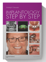 implantology step by step pdf