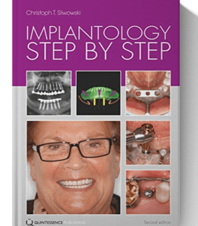 implantology step by step pdf