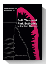 soft tissues & pink esthetics in implant therapy