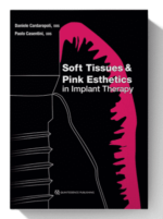 soft tissues & pink esthetics in implant therapy