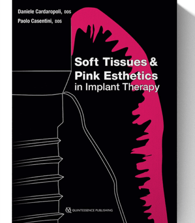 soft tissues & pink esthetics in implant therapy