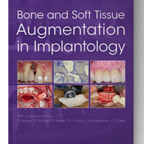 bone and soft tissue augmentation in implantology