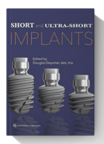 short and ultra short implants