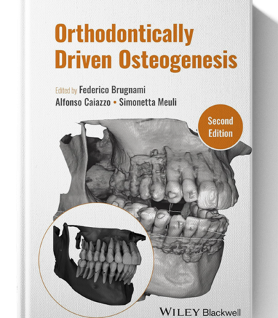 orthodontically driven osteogenesis