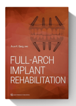 full arch implant rehabilitation