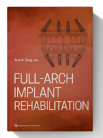 full arch implant rehabilitation