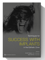 techiques for success with implants