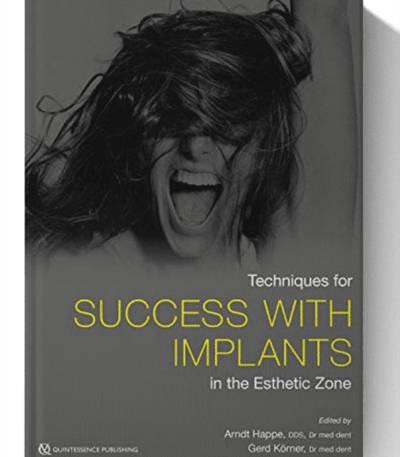 techiques for success with implants