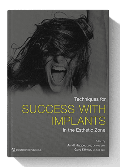 techiques for success with implants