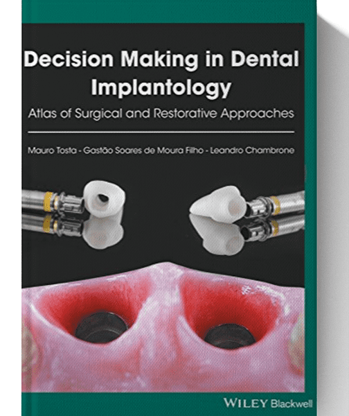 decision making in dental implantology