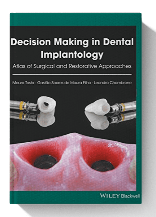 decision making in dental implantology