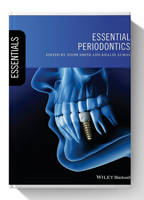 essential periodontics