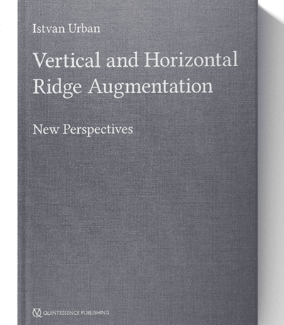 vertical and horizontal ridge augmentation