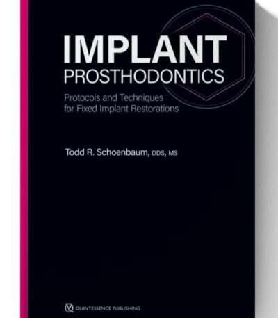 implant prosthodontics protocols and techniques