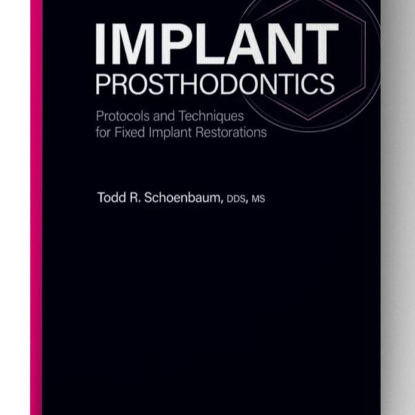 implant prosthodontics protocols and techniques