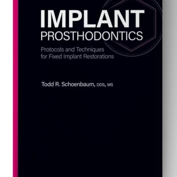 implant prosthodontics protocols and techniques