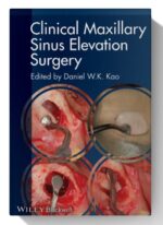 clinical maxillary sinus elevation surgery