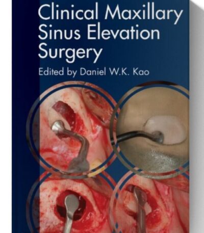 clinical maxillary sinus elevation surgery