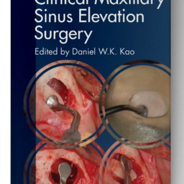 clinical maxillary sinus elevation surgery