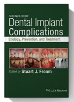 dental implant complications